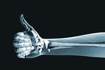 x-ray of a person holing a thumbs up